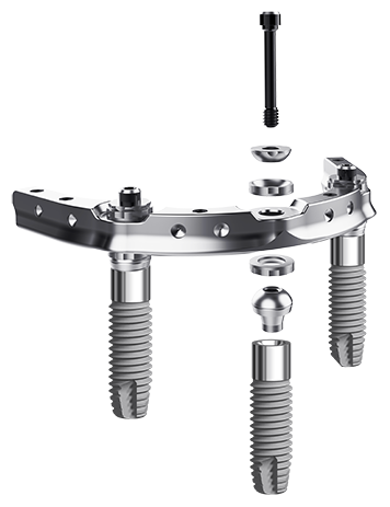 trefoil-bar-and-implants-side-view